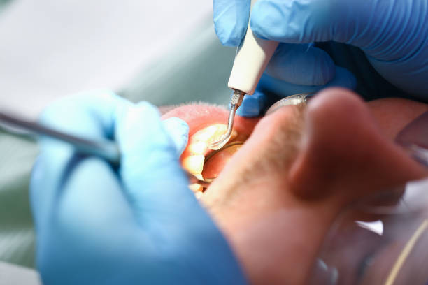 Best Walk-In Emergency Dentist in New Baltimore, VA