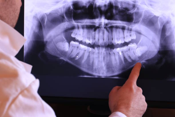 Best Emergency Wisdom Teeth Removal in New Baltimore, VA