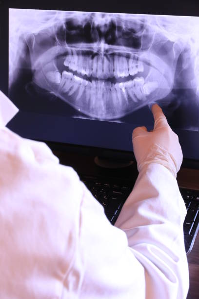 Best Emergency Tooth Extraction in New Baltimore, VA