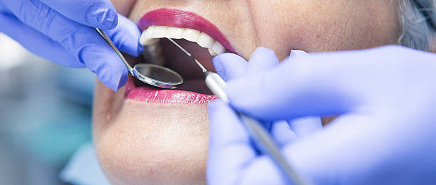 Best Emergency Tooth Extraction in New Baltimore, VA